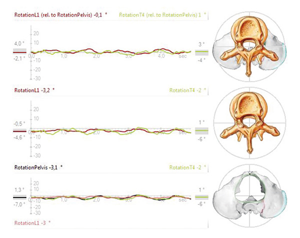 4D Motion Auswertung