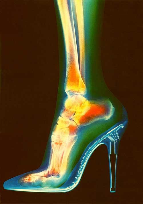 Fuß im Highheel