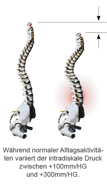 SpineMED Grafik Wirbelsäule